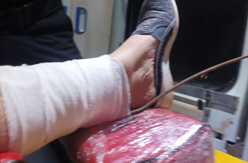  Turista se cayó y se incrustó un hierro en la pierna