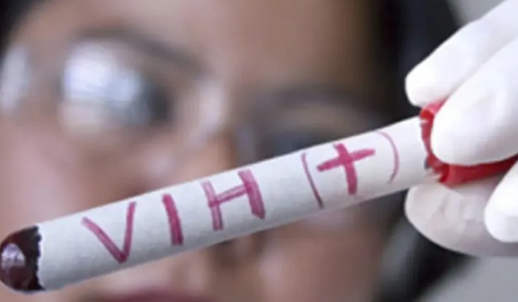  VIH: En Misiones 1 de cada 2 nuevos casos son detectados de manera tardía