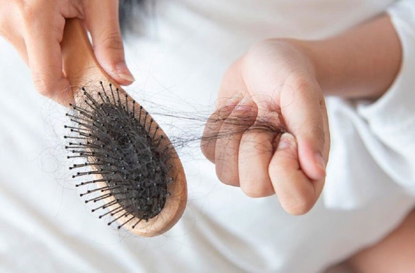  Caída del pelo: ¿un efecto posdengue?