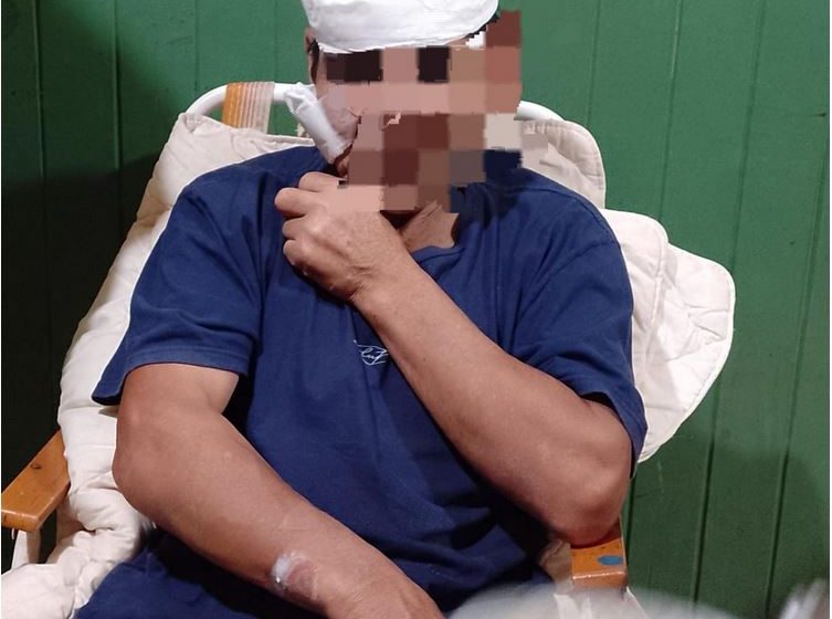  Hombre de 63 años atropellado por una moto en el barrio Las Leñas: familiares piden testigos