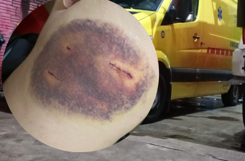  Ataque de perro: Bomberos Voluntarios solicitan mayor concientización a la comunidad